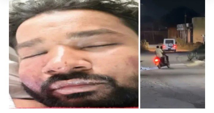 कोरबा में आधी रात गैंगवार, युवक को बोलेरो से रौंदा; दूसरे को किडनैप कर तोड़ी हाथ-पैरों की हड्डियां